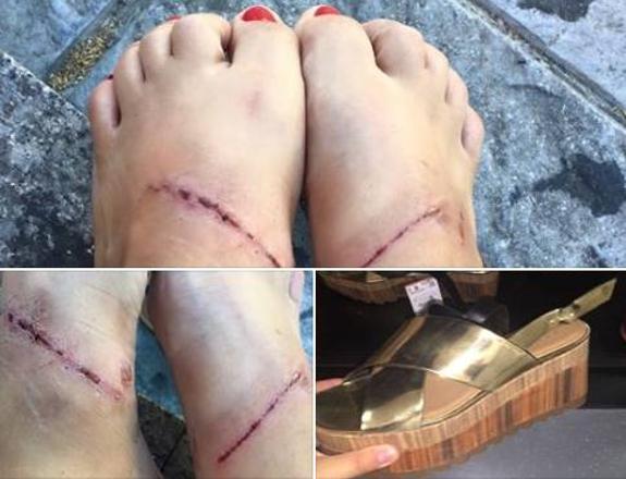 Por Las Unas Provocadas De Sandalias Zara Revolucionan Heridas nOP80wyvNm